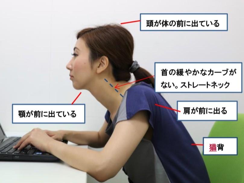 肩こりや姿勢の悪さに悩む女性が、スマホやパソコン作業で首・肩に負担を感じている写真