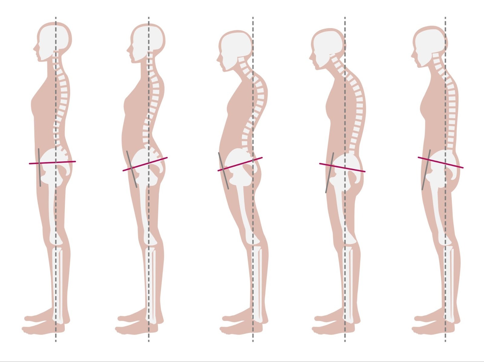 骨格のバランスのイラストです。