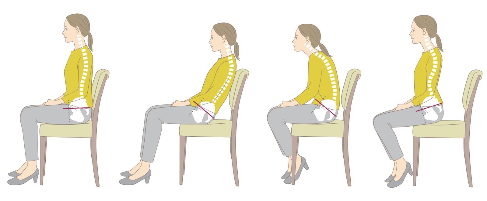 座り方によって骨盤のずれがわかるイラストです。