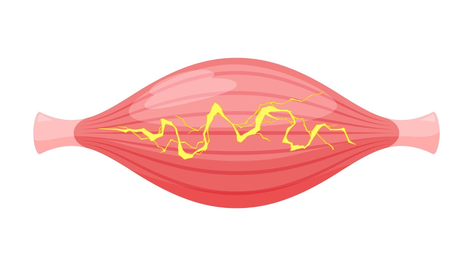 筋肉のイラストです。