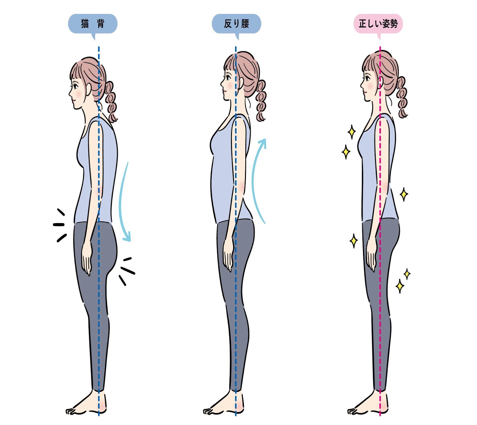 猫背・反り腰・正しい姿勢のイラストです。