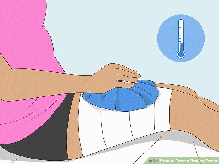 大腿部をアイシングしているイラストです。