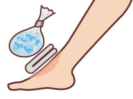足首にタオルを当ててアイシングをしているイラストです。