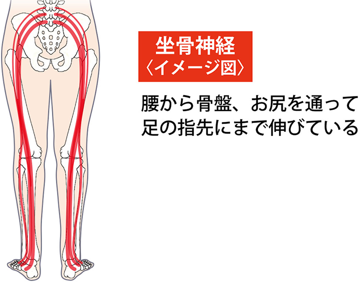 坐骨神経のイメージ図です。