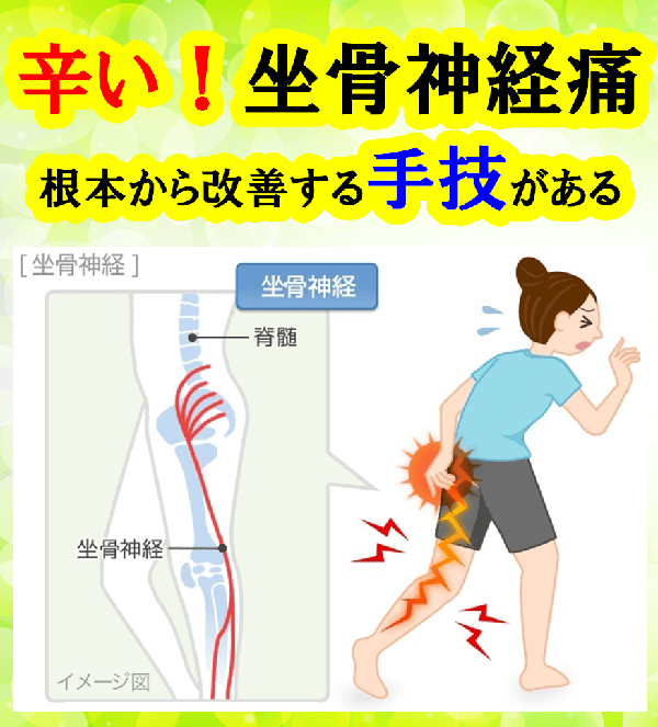 坐骨神経痛で、お尻から足までしびれている女性のイラストです。
