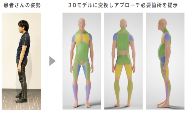 姿勢分析の写真です。姿勢をチェックしています。